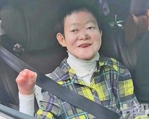 24歲罕病女壯遊西藏