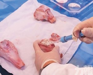 有望取代金屬固定物 有望取代金屬固定物