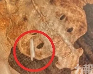 竟是22年前小學同桌惹的禍
