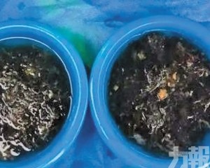 確診罕見「長髮公主綜合症」