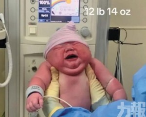 網民：他在肚子裡住了幾年？