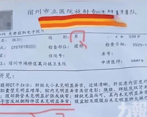 三甲醫院承認失誤並展開調查