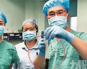 醫生巧用安全套成功取出