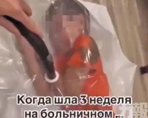 將10歲兒塞入真空袋遭警方調查