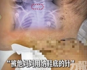 母疑有精神病警方介入調查