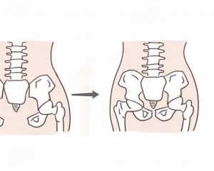 產後肚子無法回到從前？腰椎下背持續酸痛？