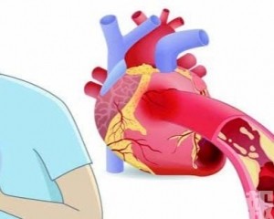 心血管疾病年輕化，怎樣才能早發現早治療？