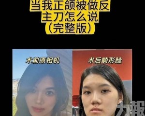 醫生反稱「臉型更洋氣」