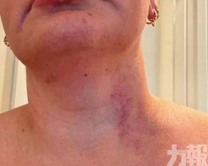 FIFA稱已聯絡新西蘭當局