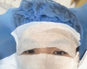 廣東男「香港腳」上臉