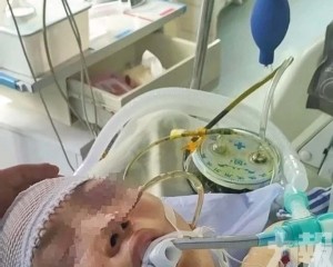 家屬指控男友長期施暴及限制自由