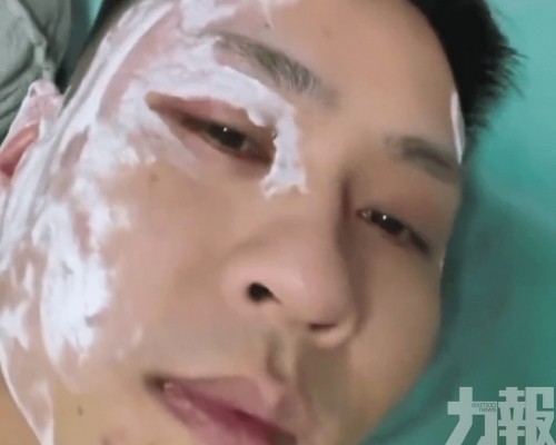 嚴重過敏險毀容