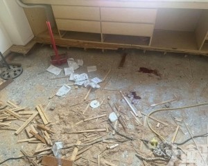「蛋蛋」掉地上急送醫接回