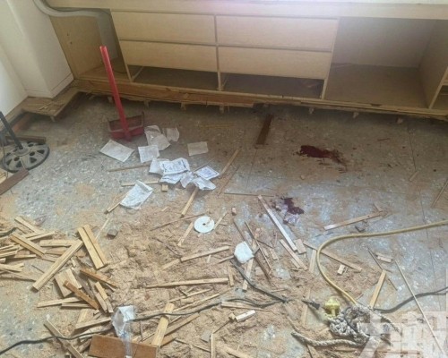 「蛋蛋」掉地上急送醫接回
