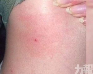 145人報稱被刺傷