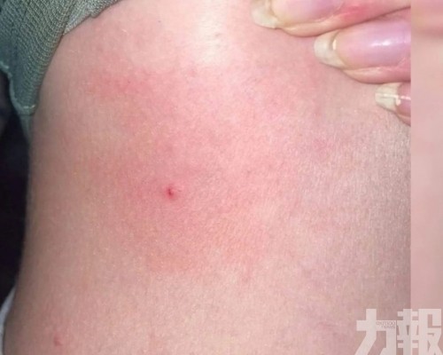 145人報稱被刺傷