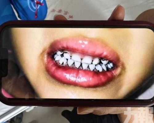 數十名學童鉛濃度超標