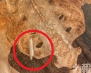 竟是22年前國小同桌惹的禍