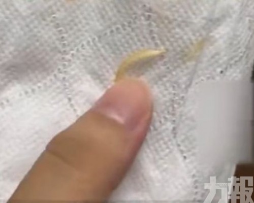 消費者投訴吃出腳指甲與煙頭