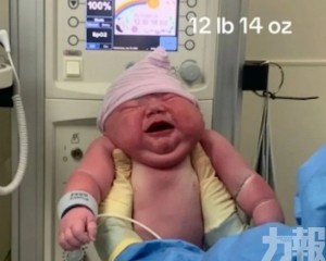 網民：他在肚子裡住了幾年？