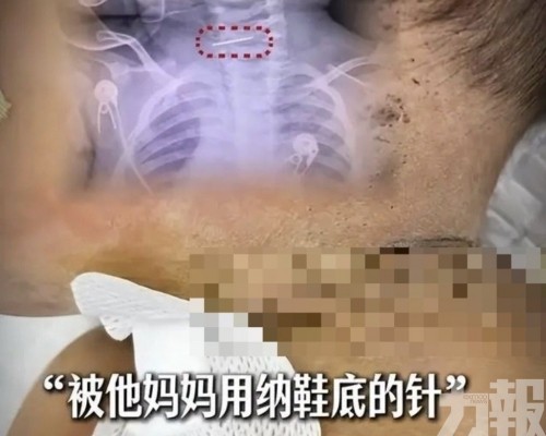 母疑有精神病警方介入調查