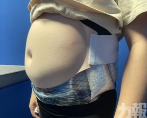 女假扮孕婦藏19公斤白銀闖關被查