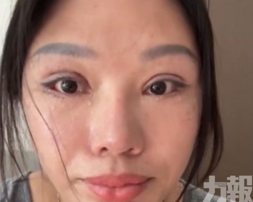 黑醫賠38萬後再追討20萬