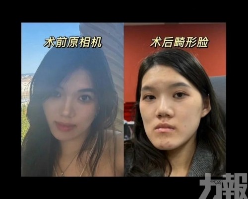 醫生反稱「臉型更洋氣」