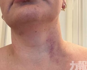 FIFA稱已聯絡新西蘭當局
