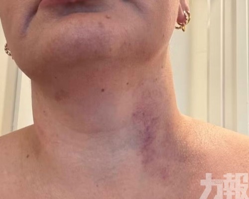 FIFA稱已聯絡新西蘭當局
