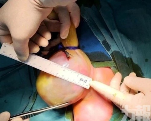 武漢醫生兩年分階段助器官歸位