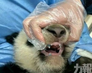 矯正下頜不對稱告別漏奶
