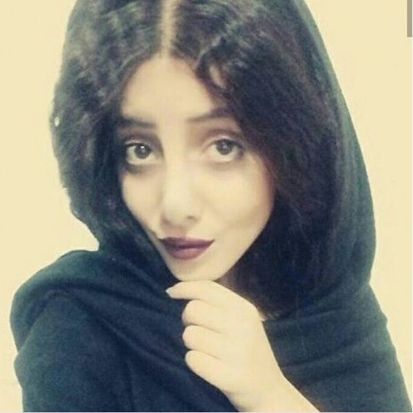 伊朗女動刀逾50次整成喪屍