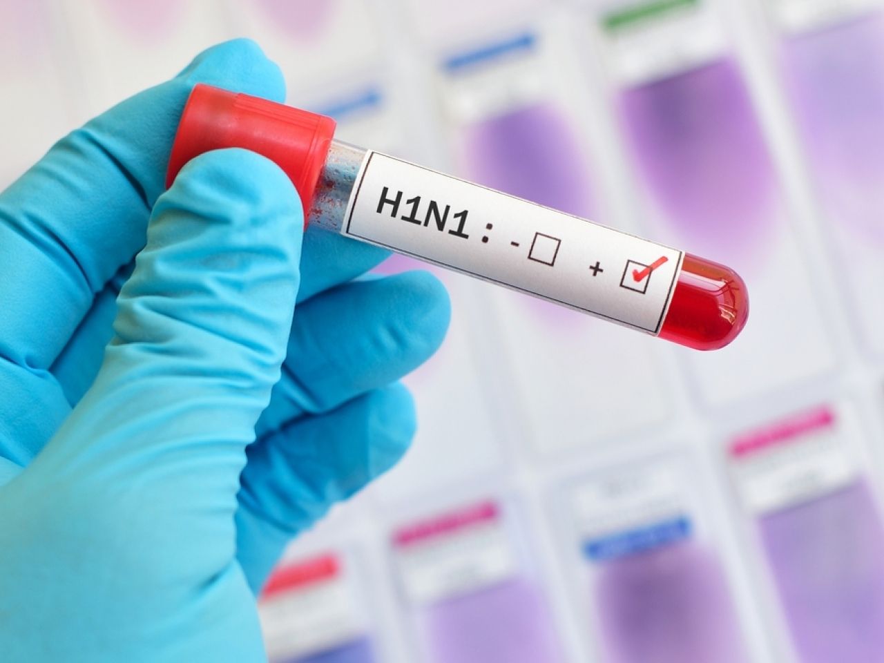 ​越南一名女子感染H1N1流感死亡
